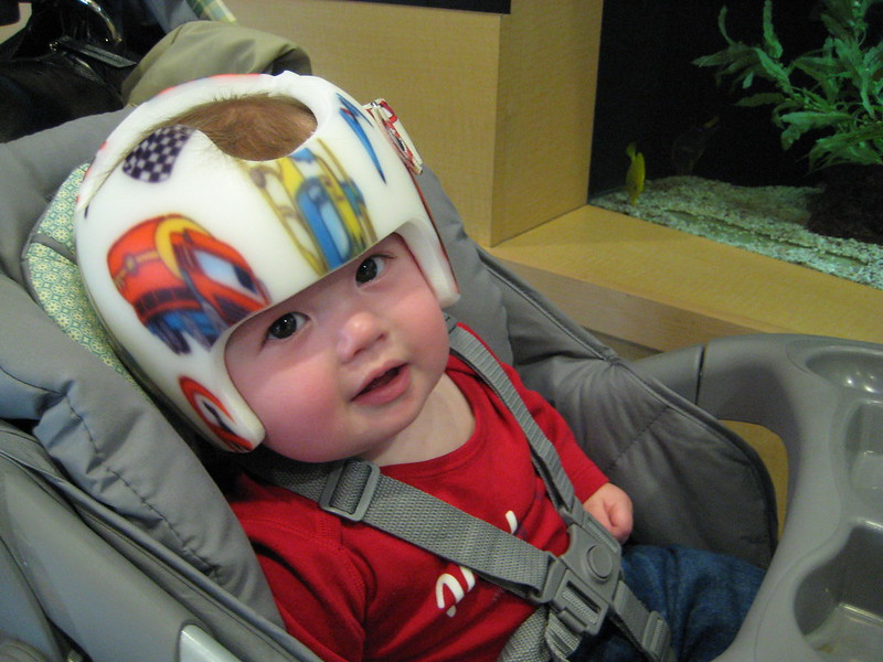 Infant in car seat with a helmet of type to manage head shape