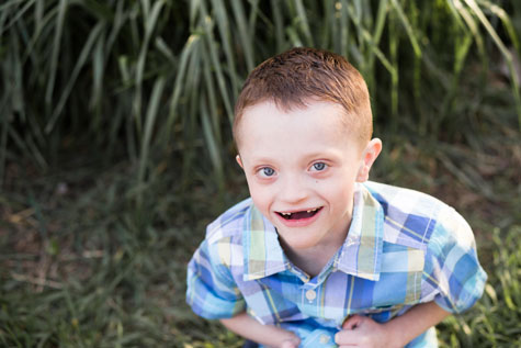 Boy with special health care need sporting a big smile with missing front teeth
